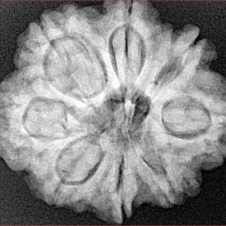 8 Mukhi Rudraksha 27.6mm 6.25gm - Xray