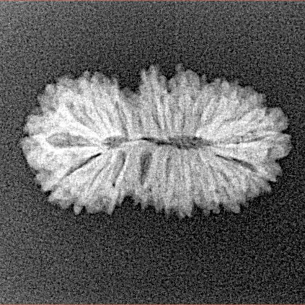 19 Mukhi Rudraksha 22.5mm 1.58gm - Xray