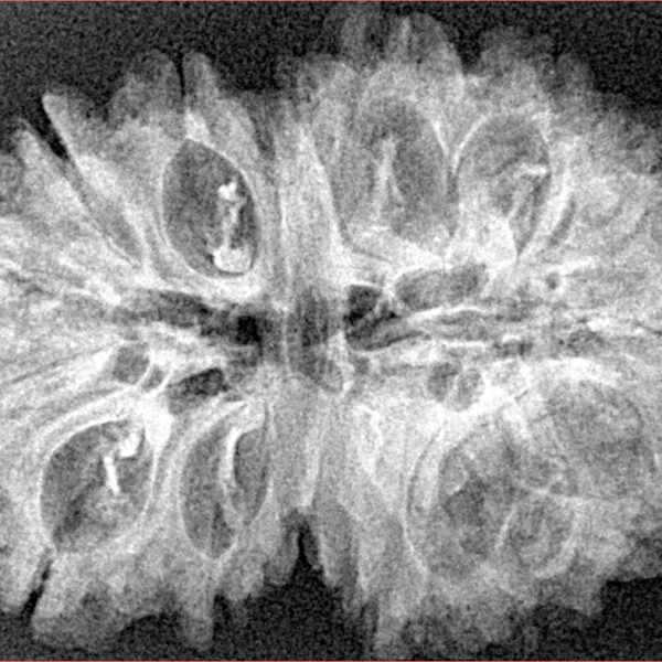 16 Mukhi Rudraksha 33.6mm 5.53gm - Xray