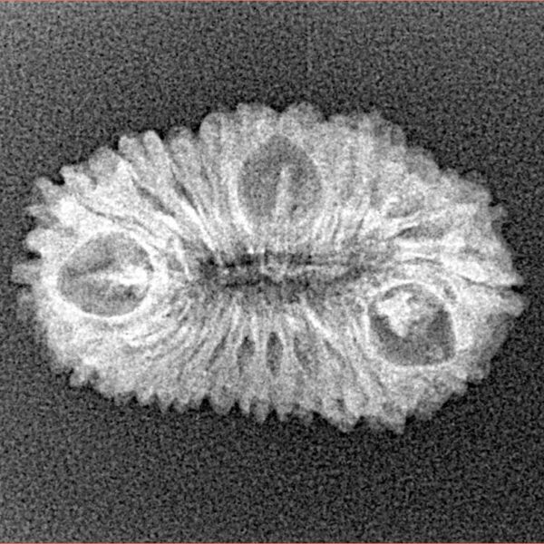 23 Mukhi Rudraksha 23.9mm 1.7gm - Xray